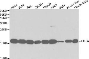 Western blot analysis of extracts of various cell lines, using EIF5A antibody. (EIF5A anticorps  (AA 1-154))