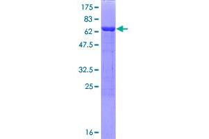 Image no. 1 for Protein Phosphatase Methylesterase 1 (PPME1) (AA 1-386) protein (GST tag) (ABIN1315931)