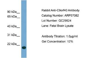 WB Suggested Anti-C9orf40  Antibody Titration: 0. (C9orf40 anticorps  (Middle Region))