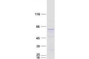 Validation with Western Blot