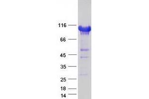 Validation with Western Blot