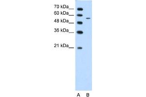 WB Suggested Anti-CHST7 Antibody Titration:  1. (CHST7 anticorps  (Middle Region))