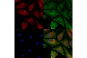 ABIN6260104 and ABIN6278139 staining  cells by IF/ICC. (ATG4A anticorps  (N-Term))