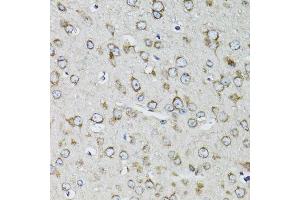 Immunohistochemistry of paraffin-embedded mouse brain using RPS10 antibody.