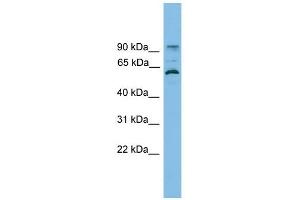 ANKRD5 antibody used at 1 ug/ml to detect target protein. (ANKRD5 anticorps  (N-Term))
