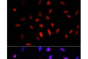 Immunofluorescence analysis of U2OS cells using COMMD1 Polyclonal Antibody at dilution of 1:100. (COMMD1 anticorps)