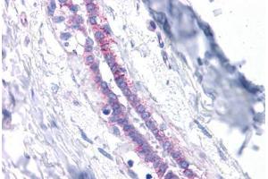 Human Breast: Formalin-Fixed, Paraffin-Embedded (FFPE)