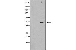 Western blot analysis of Hela whole cell lysates, using SMARCE1 Antibody.