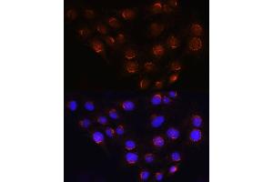 Immunofluorescence analysis of C6 cells using GOLG Rabbit pAb (ABIN6129790, ABIN6141266, ABIN6141267 and ABIN6214379) at dilution of 1:100 (40x lens). (GOLGA4 anticorps  (AA 1-150))