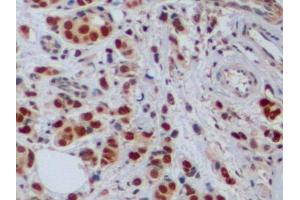 Detection of PCNA in Human Mammary gland Tissue using Polyclonal Antibody to Proliferating Cell Nuclear Antigen (PCNA) (PCNA anticorps  (AA 6-261))