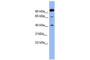WB Suggested Anti-NTSR1 Antibody Titration:  0. (NTSR1 anticorps  (N-Term))