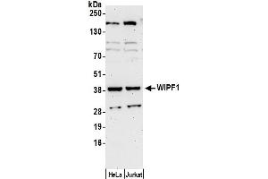 anti-WAS/WASL Interacting Protein Family, Member 1 (WIPF1) (AA 150-200) antibody
