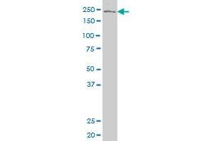 PDCD11 polyclonal antibody (A01), Lot # 051024JC01 Western Blot analysis of PDCD11 expression in MES-SA/Dx5 .