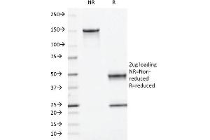SDS-PAGE Analysis Purified Moesin Mouse Monoclonal Antibody (MSN/493).