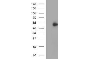Image no. 1 for anti-Interferon gamma Receptor 2 (Interferon gamma Transducer 1) (IFNGR2) antibody (ABIN1498807) (IFNGR2 anticorps)