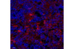 Immunofluorescence of paraffin embedded rat spleen using cfap58 (ABIN7073535) at dilution of 1: 650 (450x lens) (CCDC147 anticorps)