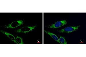 ICC/IF Image Adenylate kinase 3 antibody [N1C3] detects Adenylate kinase 3 protein at mitochondria by immunofluorescent analysis. (AK4 anticorps)
