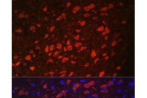 Immunofluorescence analysis of Rat brain using TRPM2 Polyclonal Antibody at dilution of 1:100.