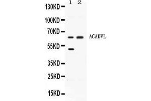 Western blot analysis of ACADVL expression in rat liver extract ( Lane 1) and HELA whole cell lysates ( Lane 2). (ACADVL anticorps  (C-Term))