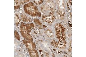 Immunohistochemical staining of human kidney with ECM1 polyclonal antibody  shows distinct cytoplasmic positivity in tubular cells combined with extra cellular immunoreactivity. (ECM1 anticorps)