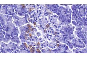 Detection of PDLIM1 in Human Pancreas Tissue using Polyclonal Antibody to PDZ And LIM Domain Protein 1 (PDLIM1) (PDLIM1 anticorps  (AA 2-329))