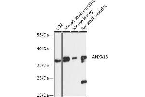 Western blot analysis of extracts of various cell lines, using  antibody (ABIN6127437, ABIN6136922, ABIN6136923 and ABIN6217829) at 1:3000 dilution. (Annexin A13 anticorps  (AA 1-316))