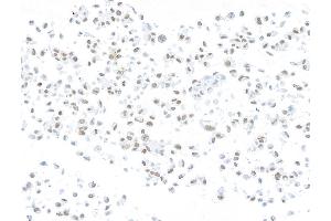 Immunocytochemistry (ICC) image for anti-AT Rich Interactive Domain 1A (SWI-Like) (ARID1A) (AA 750-800) antibody (ABIN7795678)