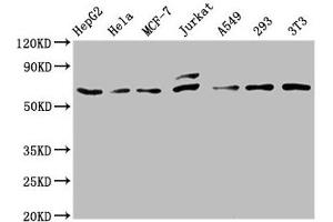 Western Blot Positive WB detected in: HepG2 whole cell lysate, Hela whole cell lysate, MCF-7 whole cell lysate, Jurkat whole cell lysate, A549 whole cell lysate, 293 whole cell lysate, NIH/3T3 whole cell lysate All lanes: c-FOS antibody at 0.
