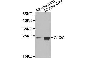 Western blot analysis of extracts of mouse lung and mouse liver cells, using C1QA antibody. (C1QA anticorps)