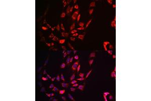 Immunofluorescence analysis of NIH-3T3 cells using TTC11/FIS1 antibody (ABIN7267209).