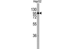 Western Blotting (WB) image for anti-Chordin (CHRD) antibody (ABIN2997784) (Chordin anticorps)