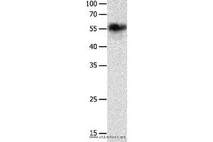 Western blot analysis of Hela cell, using CHRNA3 Polyclonal Antibody at dilution of 1:600 (CHRNA3 anticorps)