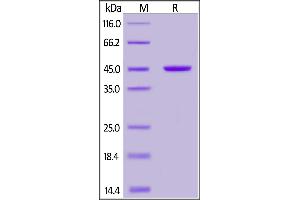 Recombinant Protein L, His Tag on  under reducing (R) condition.