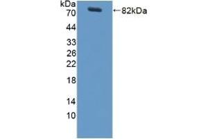 Detection of Recombinant LBP, Rat using Polyclonal Antibody to Lipopolysaccharide Binding Protein (LBP) (LBP anticorps  (AA 27-481))