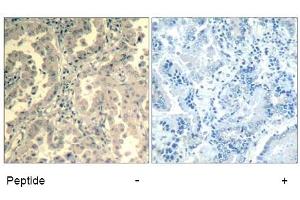 Image no. 2 for anti-Signal Transducer and Activator of Transcription 2, 113kDa (STAT2) (Tyr690) antibody (ABIN319409)