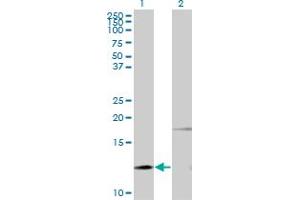 Western Blotting (WB) image for anti-Parathyroid Hormone (PTH) antibody (ABIN793030) (PTH anticorps)