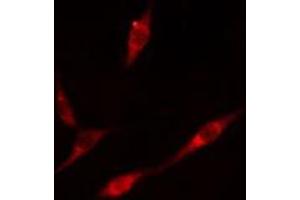 ABIN6276587 staining  A549 cells by IF/ICC. (PML anticorps  (N-Term))