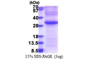 SDS-PAGE (SDS) image for Exosome Component 4 (EXOSC4) (AA 1-245) protein (His tag) (ABIN5853354)