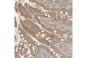 Immunohistochemical staining of human small intestine with FAM167A polyclonal antibody  shows moderate cytoplasmic positivity in glandular cells. (FAM167A anticorps)