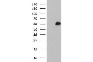 Western Blotting (WB) image for anti-Tubby Like Protein 3 (TULP3) antibody (ABIN1501586) (TULP3 anticorps)