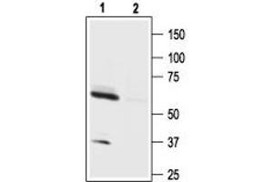 Western blot analysis of mouse brain lysate:1. (Hypocretin (Orexin) Receptor 1 (HCRTR1) Peptide)