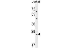 CLDN22 Antibody (Center) western blot analysis in Jurkat cell line lysates (35µg/lane). (Claudin 22 (CLDN22) (AA 97-126), (Middle Region) anticorps)