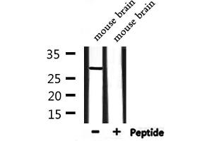 Western blot analysis of extracts from rat heart and mouse brain, using NOL7 Antibody. (NOL7 anticorps  (C-Term))