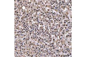 IHC analysis of SNRPD2 using anti-SNRPD2 antibody (ABIN7598963). (SNRPD2 anticorps  (AA 1-118))