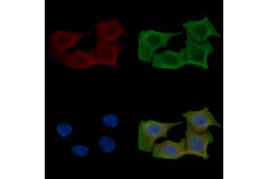ABIN6257650 and ABIN6275616 staining Hela cells(45 min of heat-shock) by IF/ICC. (SYT11 anticorps  (Internal Region))