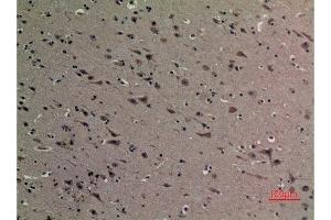 Immunohistochemistry (IHC) analysis of paraffin-embedded Human Brain, antibody was diluted at 1:100.