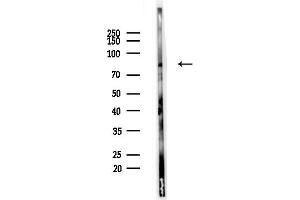 anti-Autophagy Related 13 (ATG13) (pSer355) antibody