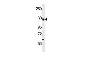 Western blot analysis in mouse liver tissue lysates (35ug/lane). (PC (AA 53-82), (N-Term) anticorps)