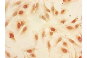 Immunocytochemistry analysis of Hela cells using ABIN7139610 at dilution of 1:100