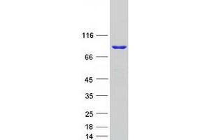 Validation with Western Blot